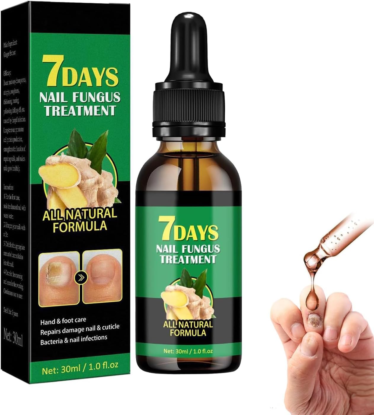 سيروم الزنجبيل