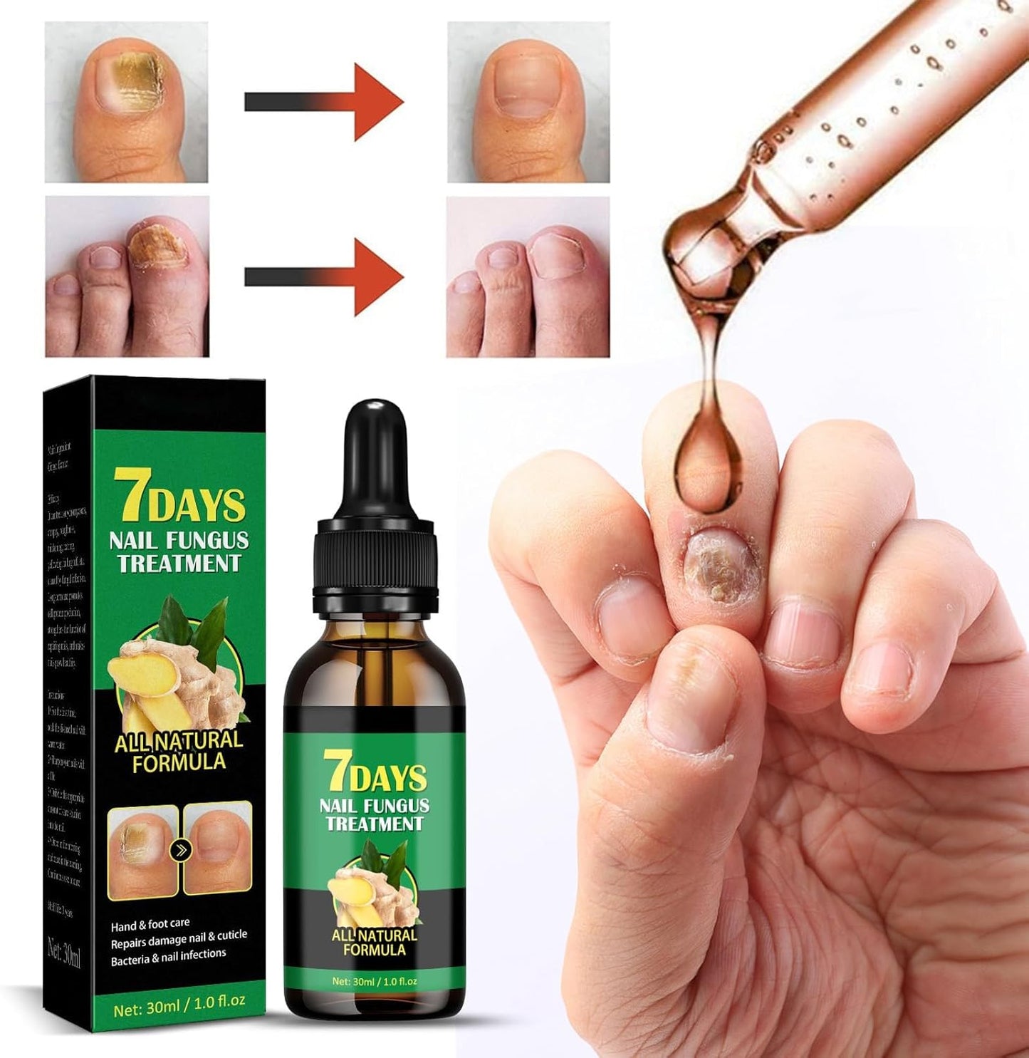 سيروم الزنجبيل